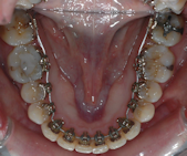 Orthodontie 91